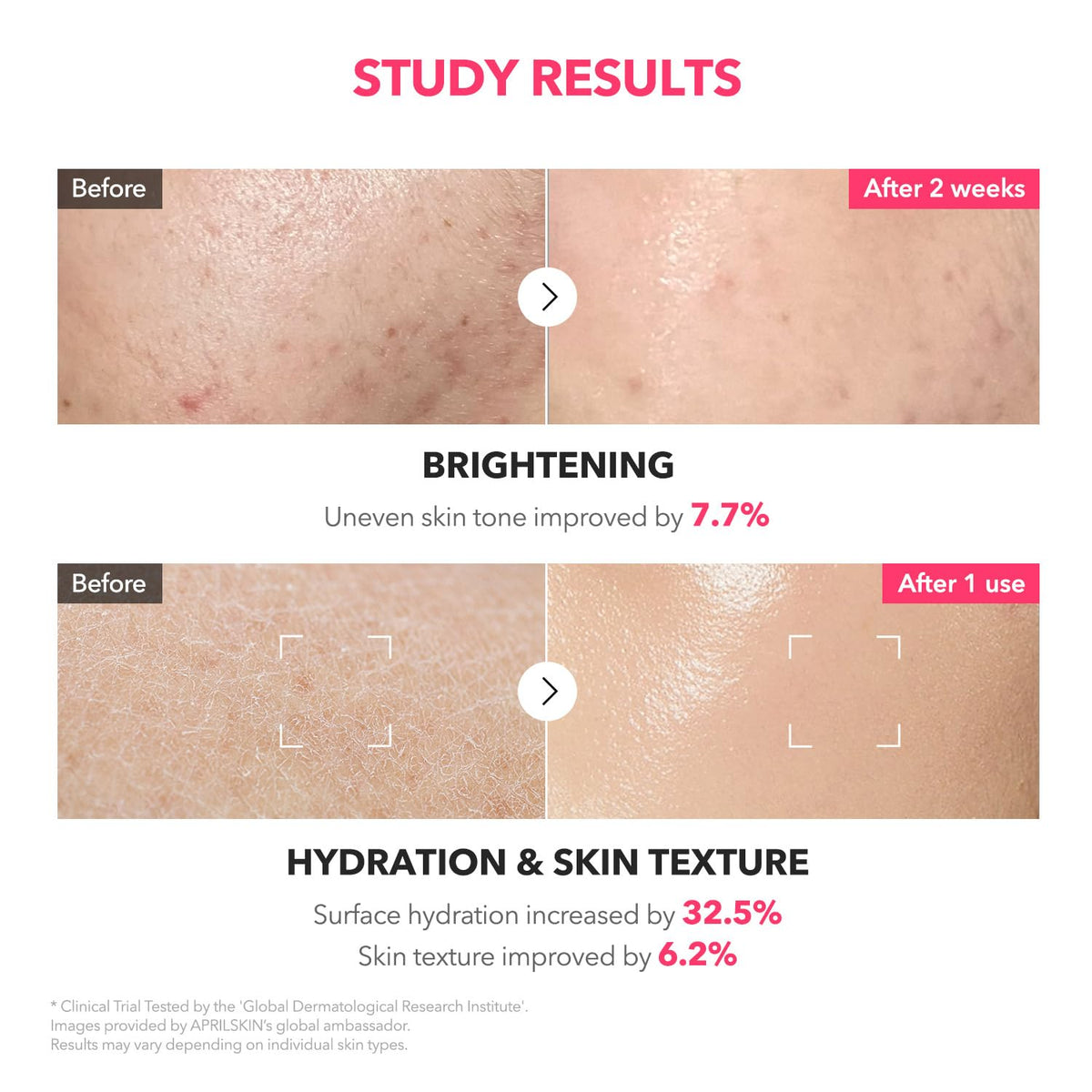 Aprilskin TXA Niacinamide 99 Milky Toner 150ml