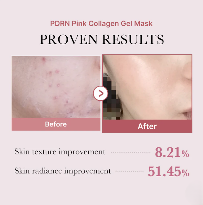 Medicube PDRN Pink Collagen Gel Mask 28g 4EA