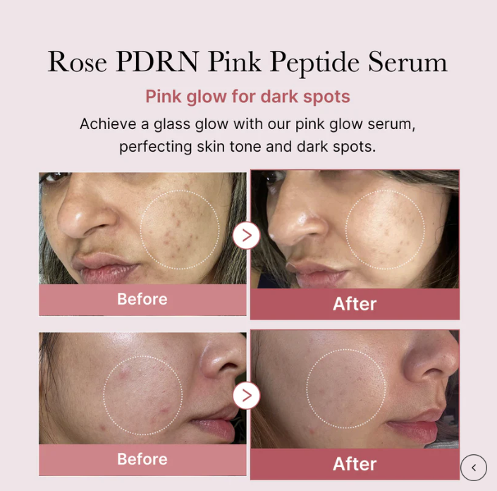 Medicube PDRN Pink Peptide Serum 30ml