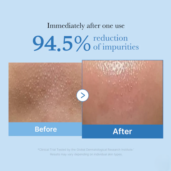 Medicube Zero Pore Blackhead Deep Cleansing Oil 205ml
